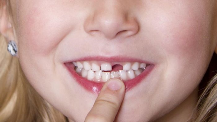Mơ về răng đánh con gì?